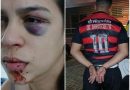 Defesa de corretora agredida por marido manifesta preocupação após Justiça revogar prisão preventiva do acusado