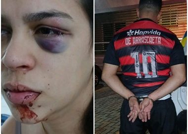 Defesa de corretora agredida por marido manifesta preocupação após Justiça revogar prisão preventiva do acusado