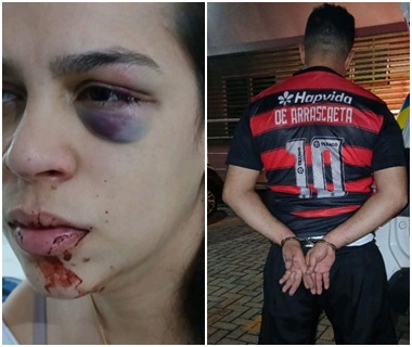 Defesa de corretora agredida por marido manifesta preocupação após Justiça revogar prisão preventiva do acusado
