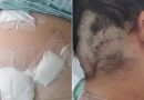 Mulher é mantida em cárcere privado, torturada e esfaqueada 12 vezes pelo companheiro no Ceará