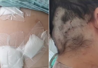 Mulher é mantida em cárcere privado, torturada e esfaqueada 12 vezes pelo companheiro no Ceará