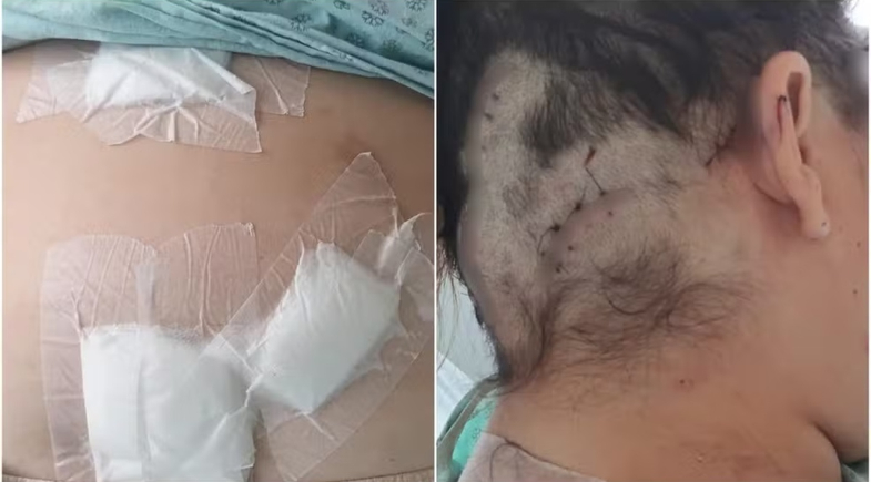 Mulher é mantida em cárcere privado, torturada e esfaqueada 12 vezes pelo companheiro no Ceará