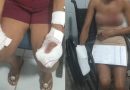 Homem é preso suspeito de atacar mãe e namorada com faca e decepar dedo das vítimas