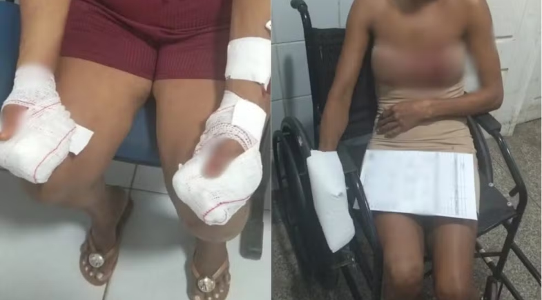 Homem é preso suspeito de atacar mãe e namorada com faca e decepar dedo das vítimas
