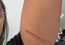 Mulher denuncia motorista de aplicativo por agressão após corrida em Teresina