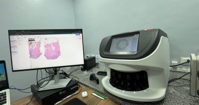 Piauí Link garante conectividade para agilizar a detecção do câncer no Hospital Getúlio Vargas (HGV)