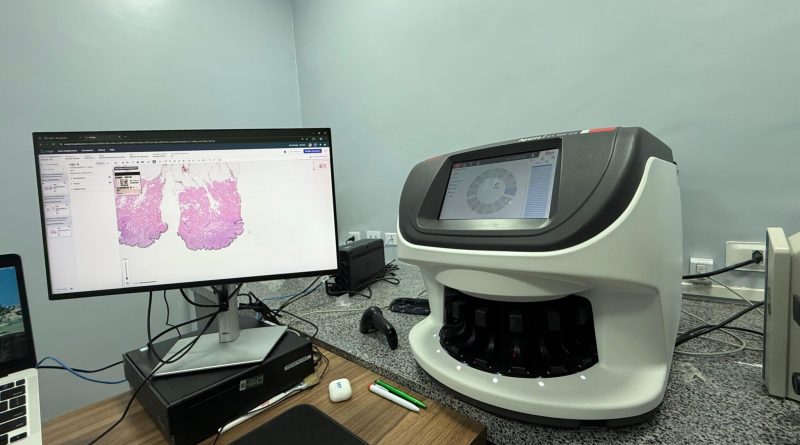Piauí Link garante conectividade para agilizar a detecção do câncer no Hospital Getúlio Vargas (HGV)